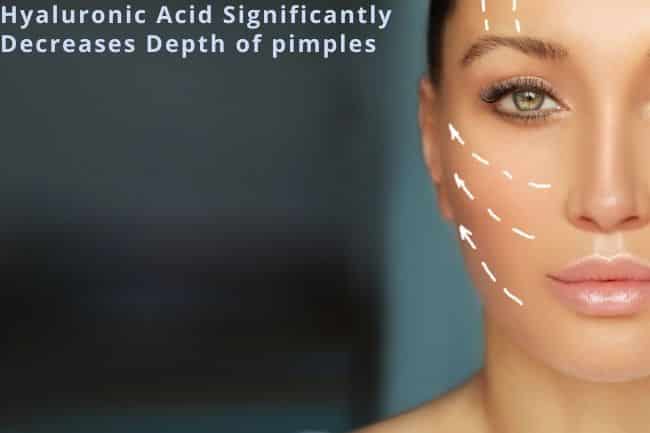 What Skincare Treatments Will Show The Immediate Anti-ageing Result?