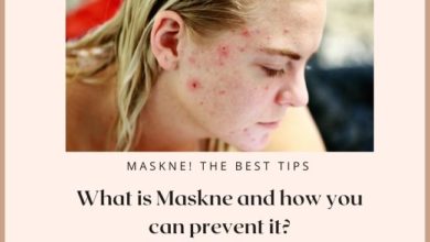 What is maskne and how you can prevent it?