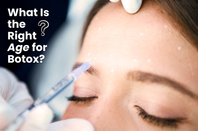 what-is-the-right-age-for-botox